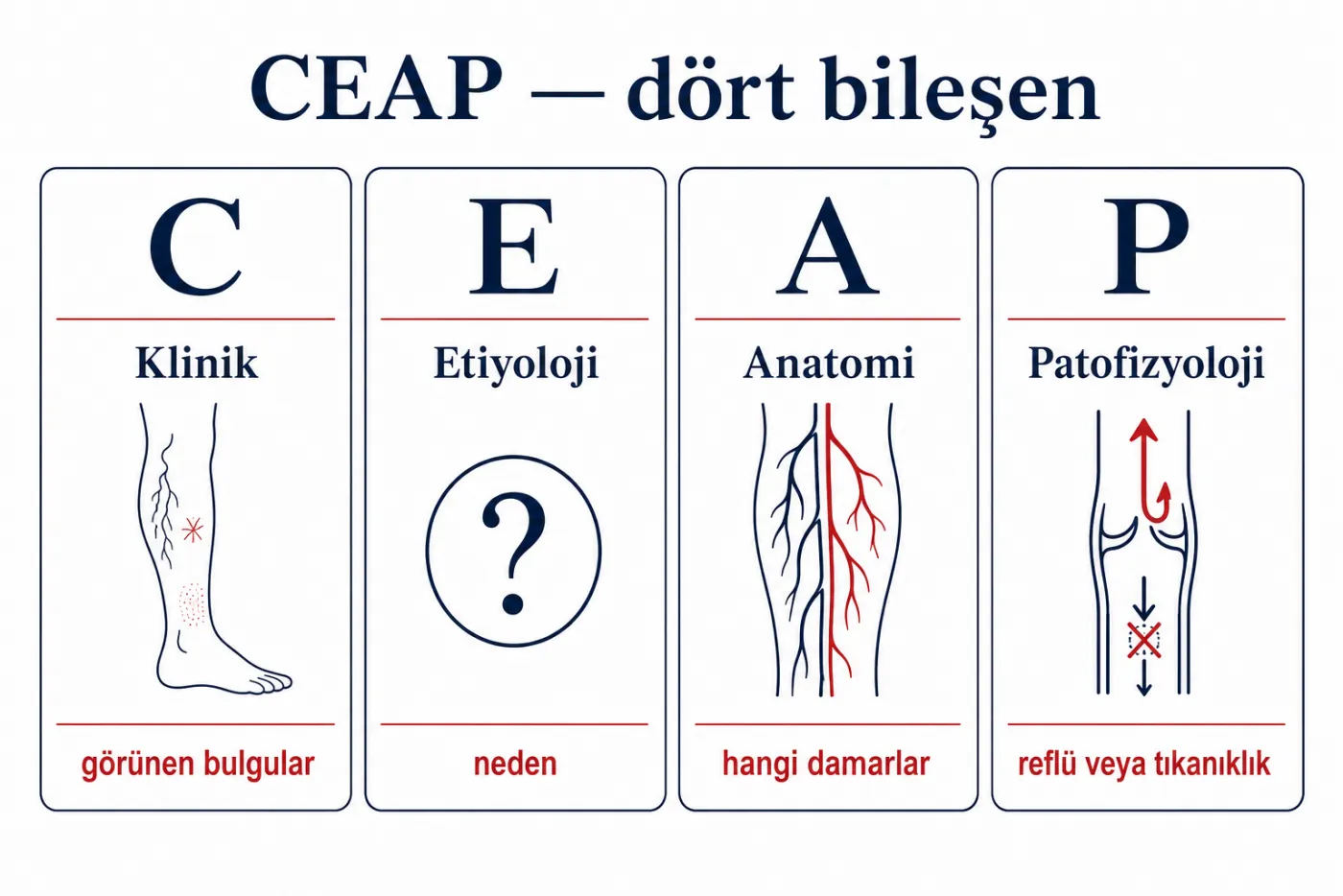 CEAP sınıflamasının dört bileşeni: klinik, etiyoloji, anatomi, patofizyoloji